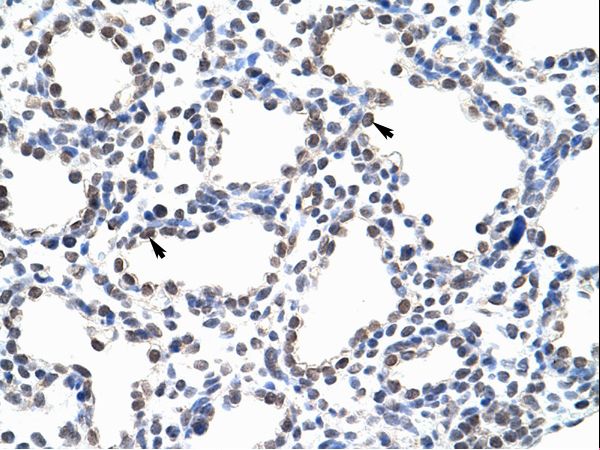 KIAA0020 antibody LS-C31722 was used in IHC to stain formalin-fixed, paraffin-embedded human lung.