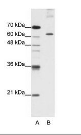 A: Marker, B: HepG2 Cell Lysate