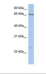 NTERA2 cell lysate. Antibody concentration: 1.0 ug/ml. Gel concentration: 12%.