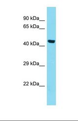 Western blot of Human HepG2. KIAA0141 antibody dilution 1.0 ug/ml.