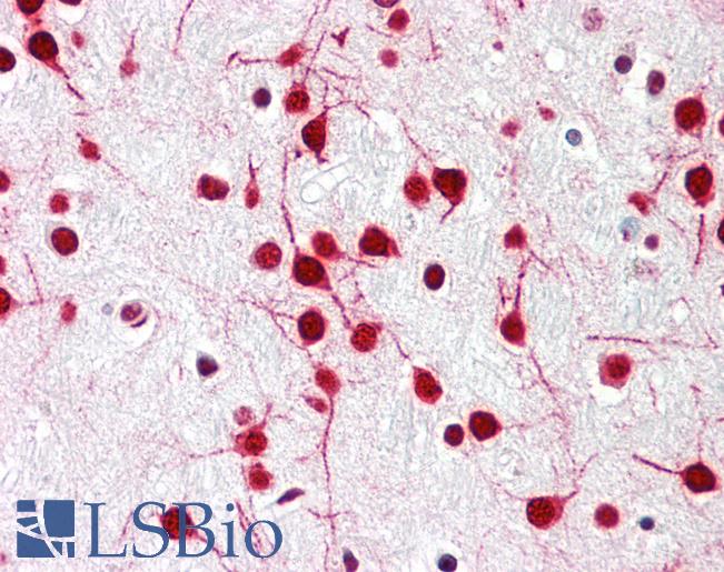 Anti-KIAA0141 antibody IHC staining of human brain, cortex. Immunohistochemistry of formalin-fixed, paraffin-embedded tissue after heat-induced antigen retrieval.