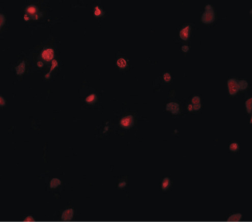 Immunofluorescence of DELE in human brain tissue with DELE antibody at 20 ug/ml.