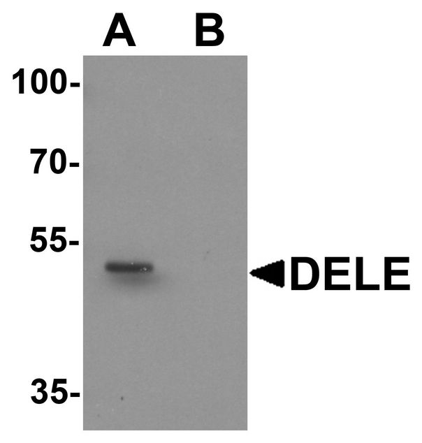 Western blot analysis of DELE in rat brain tissue lysate with DELE antibody at 1 ug/ml in (A) the absence and (B) the presence of blocking peptide.