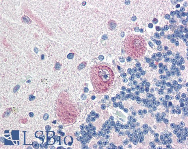 Anti-MLEC antibody LS-A9847 IHC of human brain, cerebellum. Immunohistochemistry of formalin-fixed, paraffin-embedded tissue after heat-induced antigen retrieval.