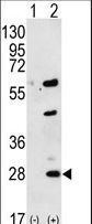 Western blot of GREM1 (arrow) using rabbit polyclonal GREM1 Antibody. 293 cell lysates (2 ug/lane) either nontransfected (Lane 1) or transiently transfected (Lane 2) with the GREM1 gene.