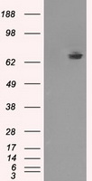 HEK293T cells were transfected with the pCMV6-ENTRY control (Left lane) or pCMV6-ENTRY TTLL12 (Right lane) cDNA for 48 hrs and lysed. Equivalent amounts of cell lysates (5 ug per lane) were separated by SDS-PAGE and immunoblotted with anti-TTLL12.