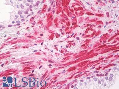 Anti-KIAA0191 / ZCCHC11 antibody IHC of human prostate. Immunohistochemistry of formalin-fixed, paraffin-embedded tissue after heat-induced antigen retrieval. Antibody LS-B8244 dilution 5-7.5 ug/ml.