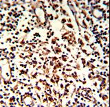 Formalin-fixed and paraffin-embedded human lymph with BARON Antibody , which was peroxidase-conjugated to the secondary antibody, followed by DAB staining. This data demonstrates the use of this antibody for immunohistochemistry; clinical relevance has not been evaluated.