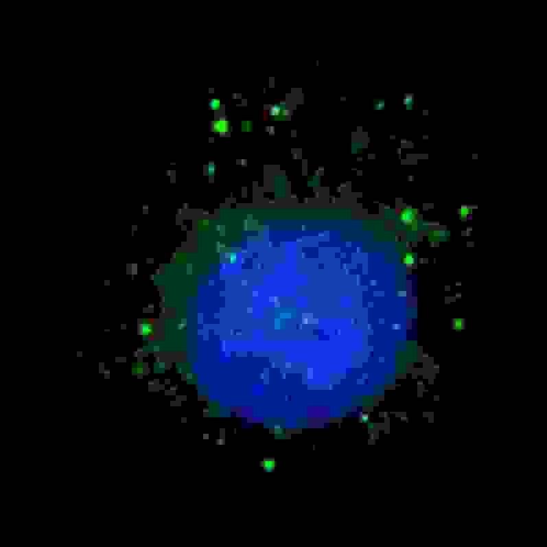 Fluorescent image of U251 cells stained with BARON antibody. U251 cells were treated with Chloroquine (50 mu M,16h), then fixed with 4% PFA (20 min), permeabilized with Triton X-100 (0.2%, 30 min). Cells were then incubated BARON primary antibody (1:100, 2 h at room temperature). For secondary antibody, Alexa Fluor 488 conjugated donkey anti-rabbit antibody (green) was used (1:1000, 1h). Nuclei were counterstained with Hoechst 33342 (blue) (10 ug/ml, 5 min). BARON immunoreactivity is localized to autophagic vacuoles in the cytoplasm of U251 cells.