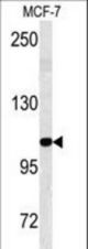 Western blot of BARON antibody in MCF-7 cell line lysates (35 ug/lane). BARON (arrow) was detected using the purified antibody.