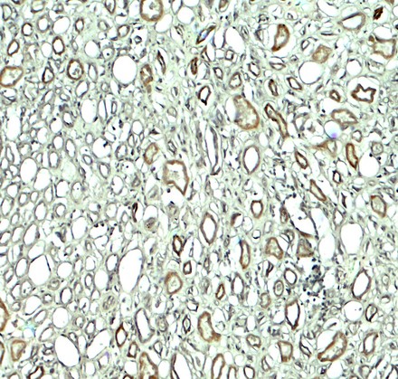 Immunohistochemistry of RUBICON in human kidney tissue with RUBICON antibody at 5 ug/ml.