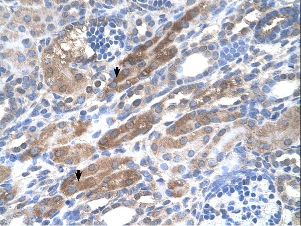 KIAA0319 antibody LS-C80992 was used in IHC to stain formalin-fixed, paraffin-embedded human kidney.