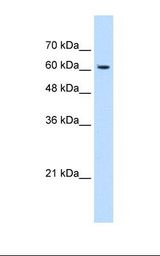 HepG2 cell lysate. Antibody concentration: 1.25 ug/ml. Gel concentration: 12%.