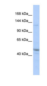 KIAA0319L antibody LS-C111242 Western blot of MCF7 cell lysate.