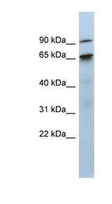 CTIF / KIAA0427 antibody LS-C110567 Western blot of Fetal Small Intestine lysate.