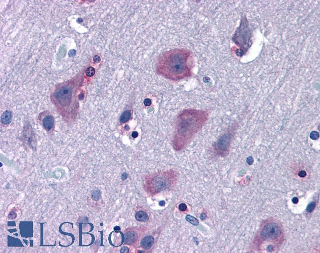 Anti-TRIM2 / RNF86 antibody IHC of human brain, cortex. Immunohistochemistry of formalin-fixed, paraffin-embedded tissue after heat-induced antigen retrieval. Antibody LS-B4967 concentration 6.25 ug/ml.