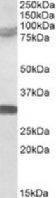 TRIM2 antibody (0.5 ug/ml) staining of Rat Brain lysate (35 ug protein/ml in RIPA buffer). Primary incubation was 1 hour. Detected by chemiluminescence.