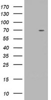 HEK293T cells were transfected with the pCMV6-ENTRY control (Left lane) or pCMV6-ENTRY TRIM2 (Right lane) cDNA for 48 hrs and lysed. Equivalent amounts of cell lysates (5 ug per lane) were separated by SDS-PAGE and immunoblotted with anti-TRIM2.