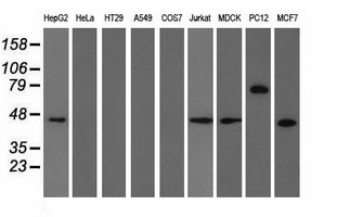 Western blot of extracts (35 ug) from 9 different cell lines by using anti-TRIM2 monoclonal antibody.