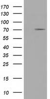 HEK293T cells were transfected with the pCMV6-ENTRY control (Left lane) or pCMV6-ENTRY TRIM2 (Right lane) cDNA for 48 hrs and lysed. Equivalent amounts of cell lysates (5 ug per lane) were separated by SDS-PAGE and immunoblotted with anti-TRIM2.
