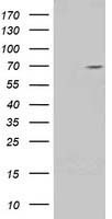 HEK293T cells were transfected with the pCMV6-ENTRY control (Left lane) or pCMV6-ENTRY TRIM2 (Right lane) cDNA for 48 hrs and lysed. Equivalent amounts of cell lysates (5 ug per lane) were separated by SDS-PAGE and immunoblotted with anti-TRIM2.