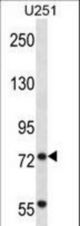 TRIM2 Antibody western blot of U251 cell line lysates (35 ug/lane). The TRIM2 antibody detected the TRIM2 protein (arrow).