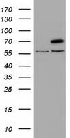 HEK293T cells were transfected with the pCMV6-ENTRY control (Left lane) or pCMV6-ENTRY TRIM2 (Right lane) cDNA for 48 hrs and lysed. Equivalent amounts of cell lysates (5 ug per lane) were separated by SDS-PAGE and immunoblotted with anti-TRIM2.