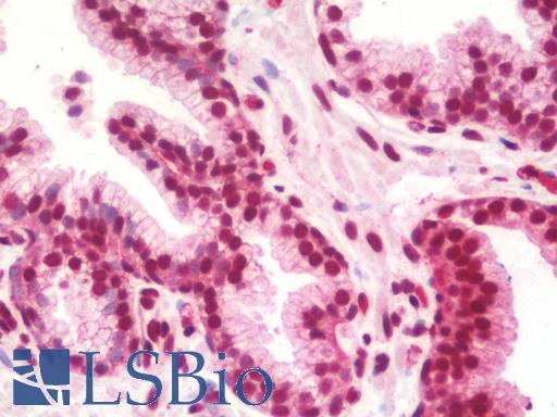 Anti-KIAA0652 / ATG13 antibody IHC staining of human prostate. Immunohistochemistry of formalin-fixed, paraffin-embedded tissue after heat-induced antigen retrieval. Antibody LS-B10936 concentration 5 ug/ml.