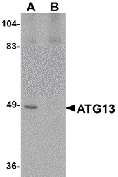 Western blot of rat heart tissue lysate probed with Rabbit anti-Mouse ATG13 at 1uM in the absence (A) or presence (B) of blocking peptide