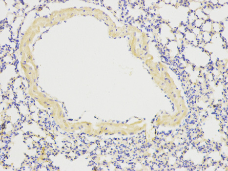 Immunohistochemistry of paraffin-embedded mouse lung using ATG13 antibody at dilution of 1:200 (200x lens).