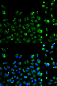 Immunofluorescence analysis of A549 cell using ATG13 antibody. Blue: DAPI for nuclear staining.