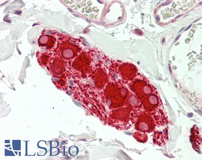 Human Colon, Submucosal Plexus: Formalin-Fixed, Paraffin-Embedded (FFPE)