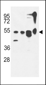 ATG13 Antibody western blot of MDA-MB435,CEM,T47D cell line and mouse cerebellum tissue lysates (35 ug/lane). The ATG13 antibody detected the ATG13 protein (arrow).