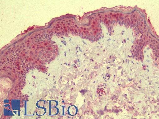 Anti-KIAA0692 / ANKLE2 antibody IHC staining of human skin. Immunohistochemistry of formalin-fixed, paraffin-embedded tissue after heat-induced antigen retrieval. Antibody LS-B9601 concentration 5 ug/ml.