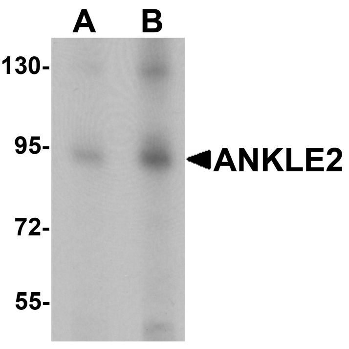Western blot analysis of ANKLE2 in SW480 cell lysate with ANKLE2 antibody at (A) 1 and (B) 2 ug/ml.