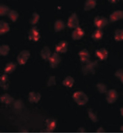 Immunofluorescence of ATP2C2 in 3T3 cells with ATP2C2 antibody at 20 ug/ml.