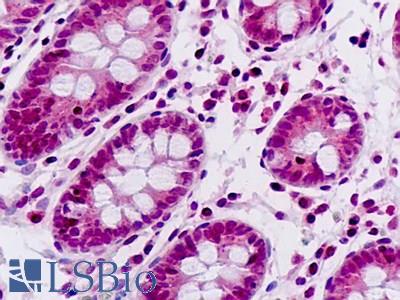 Human, Small Intestine: Formalin-Fixed Paraffin-Embedded (FFPE)