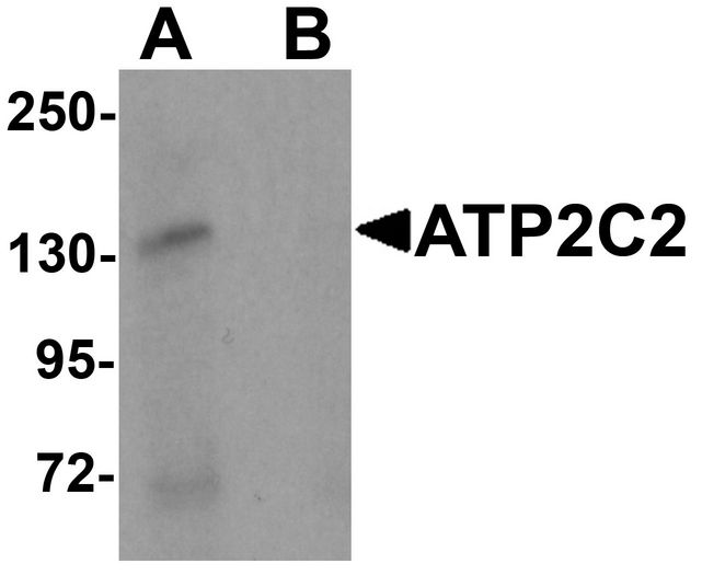 Western blot analysis of ATP2C2 in 3T3 cell lysate with ATP2C2 antibody at 1 ug/ml in (A) the absence and (B) the presence of blocking peptide.