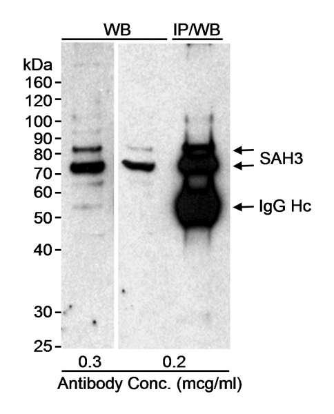 Detection of Human SAH3 by Western Blot and Immunoprecipitation. Samples: NETN whole cell lysate (20 ug for WB; 1 mg for IP) from HeLa cells. Antibody: Affinity purified rabbit anti-SAH3 antibody used at the indicated concentration for WB and 2 ug/mg lysate for IP. Detection: HRP conjugated goat anti-rabbit IgG used at 1:10000 followed by a chemiluminescent substrate and exposure to film for 10 seconds.