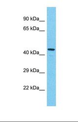 Western blot of Human MCF7. KIAA0895L antibody dilution 1.0 ug/ml.