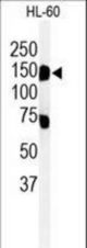 Western blot of T131L Antibody in HL-60 cell line lysates (35 ug/lane). T131L (arrow) was detected using the purified antibody.