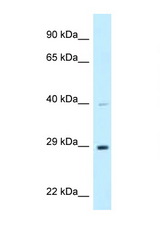 DNAJC9 antibody LS-C145836 Western blot of 721_B Cell lysate. Antibody concentration 1 ug/ml.