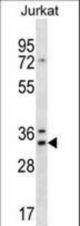 DNAJC9 Antibody western blot of Jurkat cell line lysates (35 ug/lane). The DNAJC9 antibody detected the DNAJC9 protein (arrow).