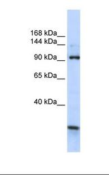 Fetal brain lysate. Antibody concentration: 1.0 ug/ml. Gel concentration: 6-18%.
