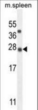 K1143 Antibody western blot of mouse spleen tissue lysates (35 ug/lane). The K1143 antibody detected the K1143 protein (arrow).