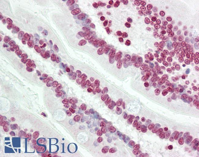 Human Small Intestine: Formalin-Fixed, Paraffin-Embedded (FFPE)