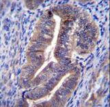K1324 Antibody immunohistochemistry of formalin-fixed and paraffin-embedded human uterus tissue followed by peroxidase-conjugated secondary antibody and DAB staining.