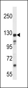 K1324 Antibody western blot of MDA-MB435 cell line lysates (35 ug/lane). The K1324 antibody detected the K1324 protein (arrow).