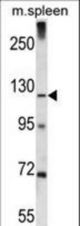 K1324 Antibody western blot of mouse spleen tissue lysates (35 ug/lane). The K1324 antibody detected the K1324 protein (arrow).