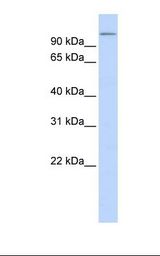 Fetal brain lysate. Antibody concentration: 1.0 ug/ml. Gel concentration: 12%.